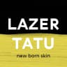MAX-канал Удаление тату LAZERTATU